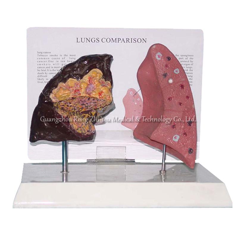 Lung Structure Anatomical Model Lung Structure Anatomical Model
