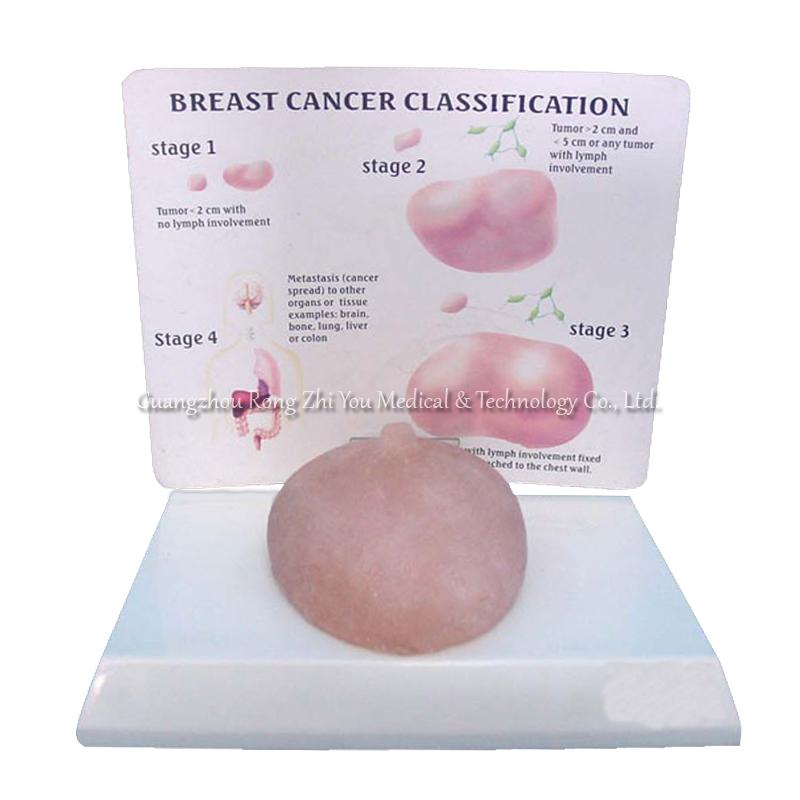 Human Breast Model