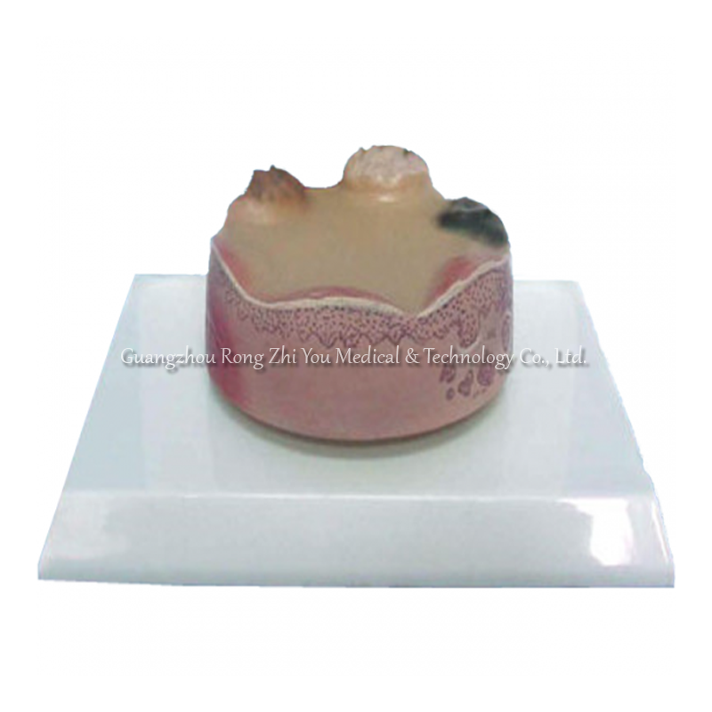 Skin Demonstration Model 