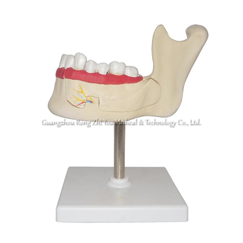 Teeth and Jaw Model Teeth and Jaw Model