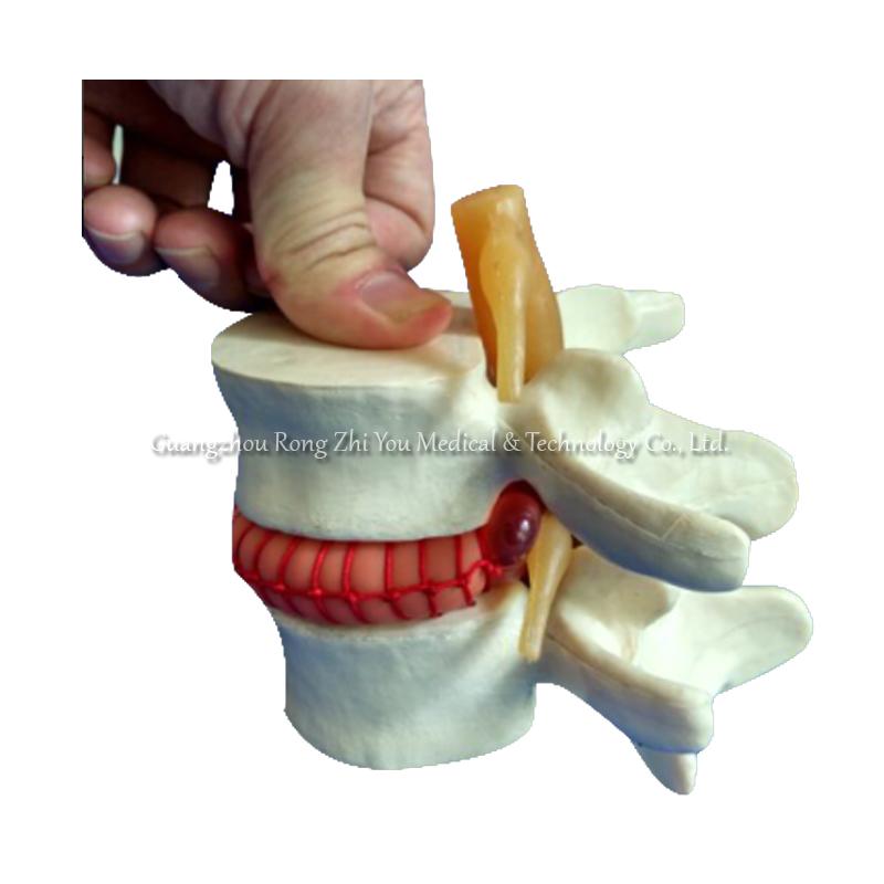 Vertebral Simulator Model Vertebral Simulator Model