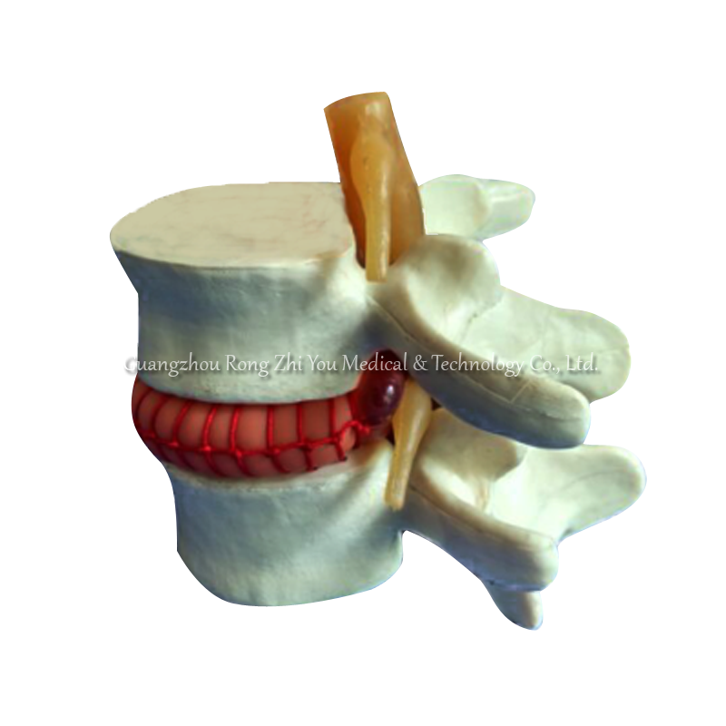 Vertebral Simulator Model Vertebral Simulator Model