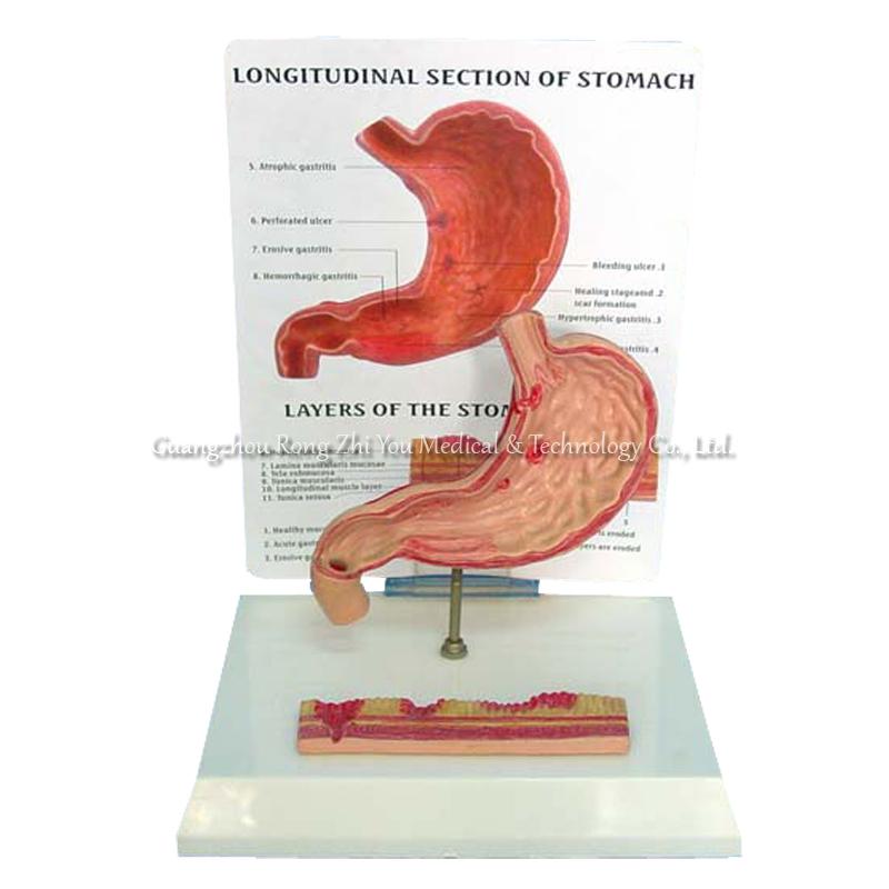 Human Stomach Model
